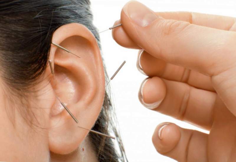 Recensioni esperte di orecchini dimagranti magnetici
